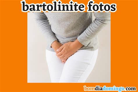 bartolinite fotos-4